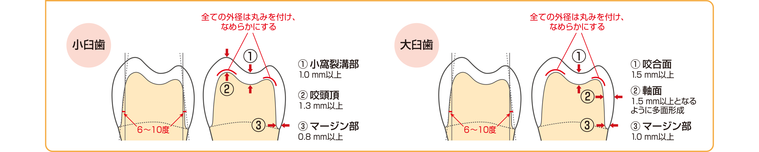 支台歯形成量ガイド用ダイヤモンドバー プレップマーカー / 総合歯科