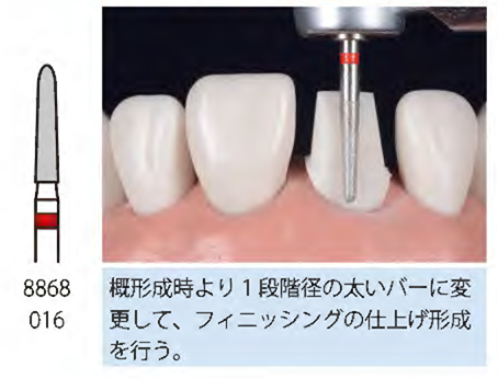 Dr. Iwata クラウン/べニア形成・CR形態修正バーセット / 総合歯科材料